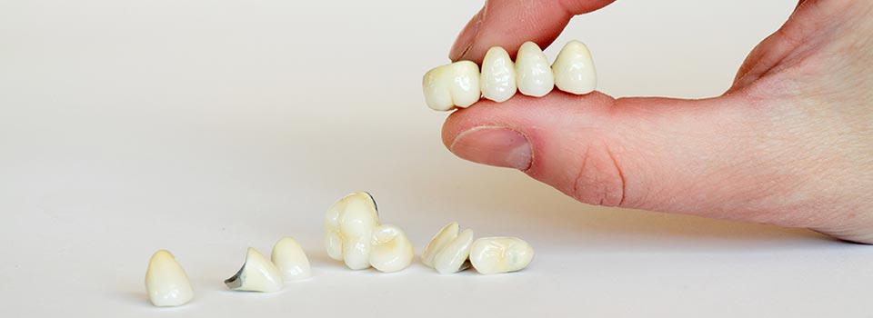Tooth models